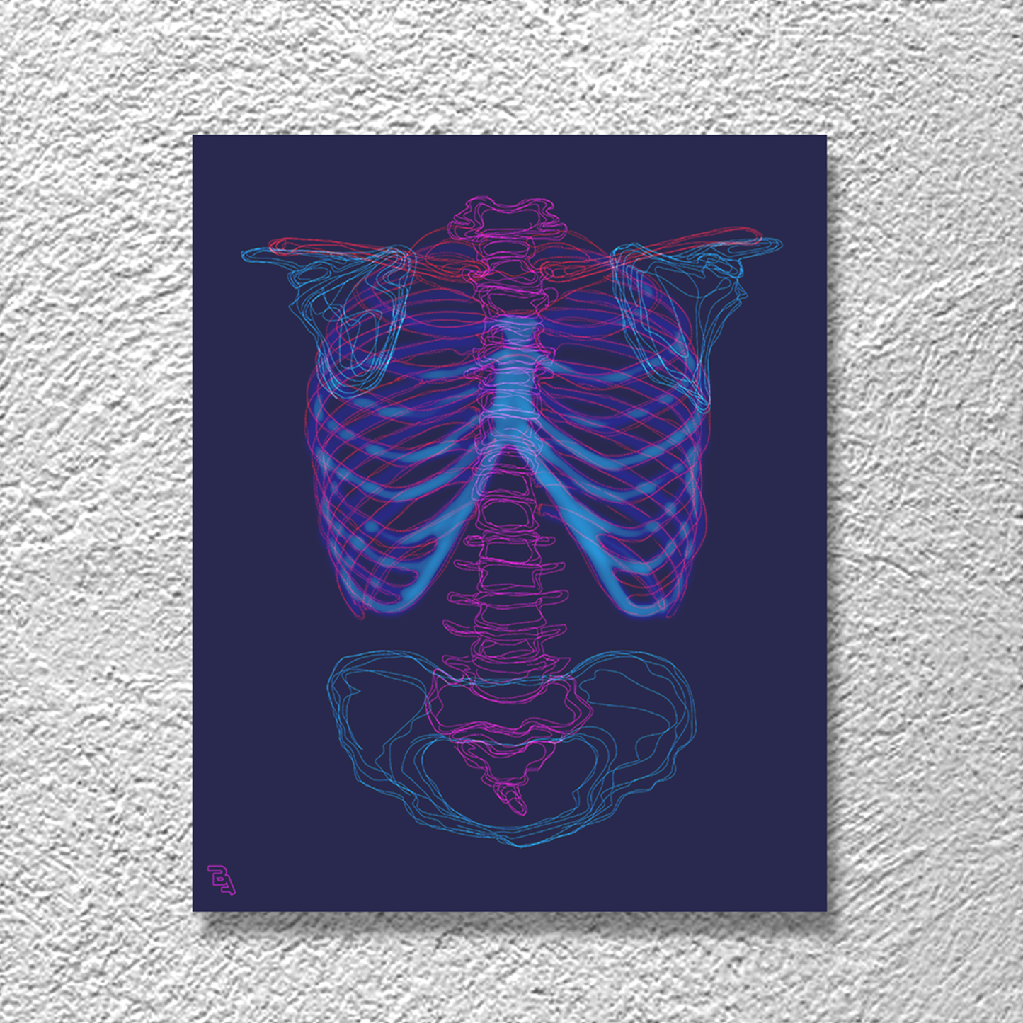 "Ribs and Pelvis" canvas print